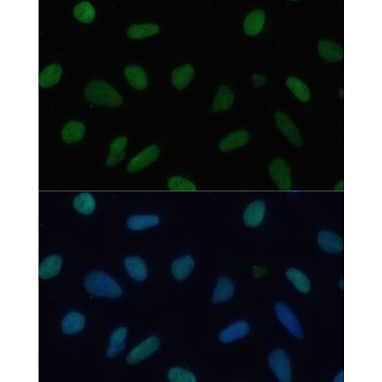 Immunofluorescence - Anti-KAP1 Antibody (A13965) - Antibodies.com