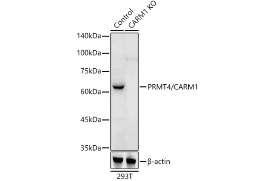 Western Blot - Anti-CARM1 Antibody (A13966) - Antibodies.com
