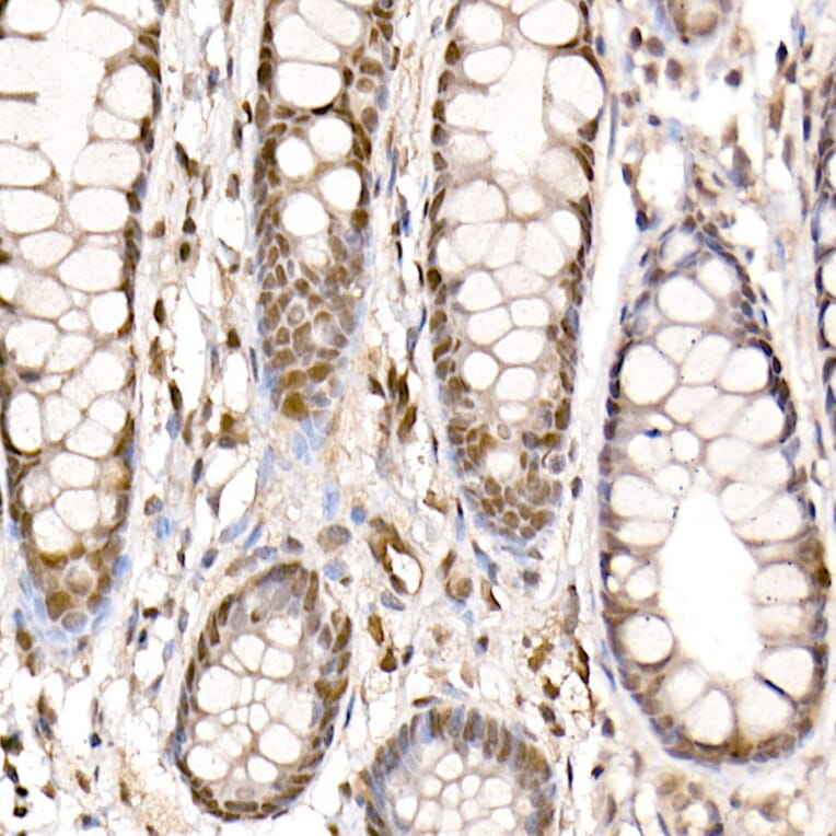 Immunohistochemistry - Anti-CARM1 Antibody (A13966) - Antibodies.com
