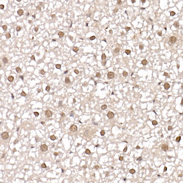Immunohistochemistry - Anti-CARM1 Antibody (A13966) - Antibodies.com