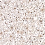 Immunohistochemistry - Anti-CARM1 Antibody (A13966) - Antibodies.com