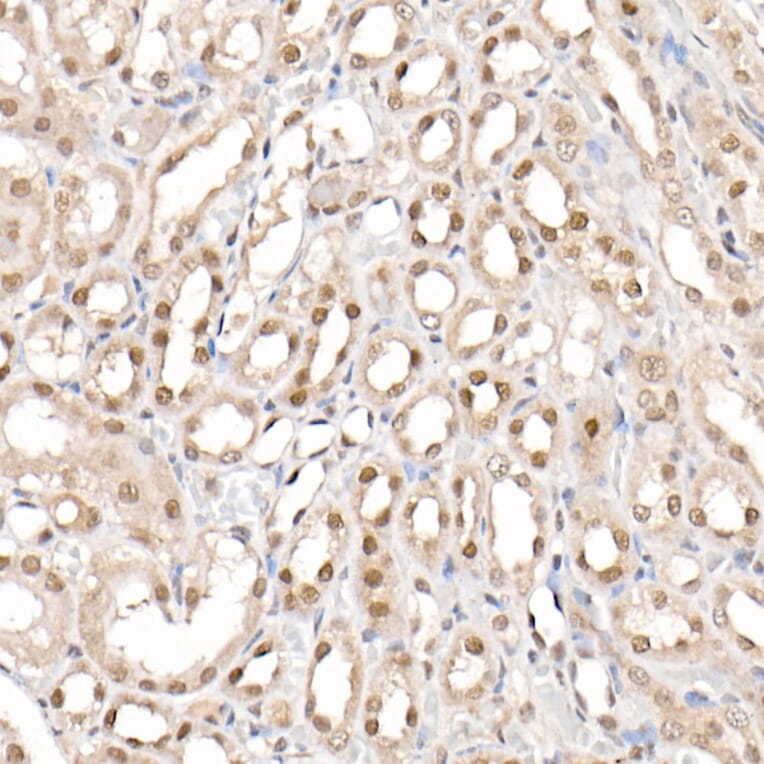 Immunohistochemistry - Anti-CARM1 Antibody (A13966) - Antibodies.com