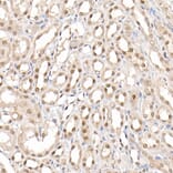 Immunohistochemistry - Anti-CARM1 Antibody (A13966) - Antibodies.com