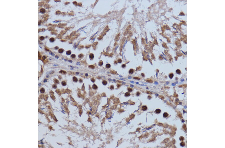 Immunohistochemistry - Anti-Brd4 Antibody (A13967) - Antibodies.com