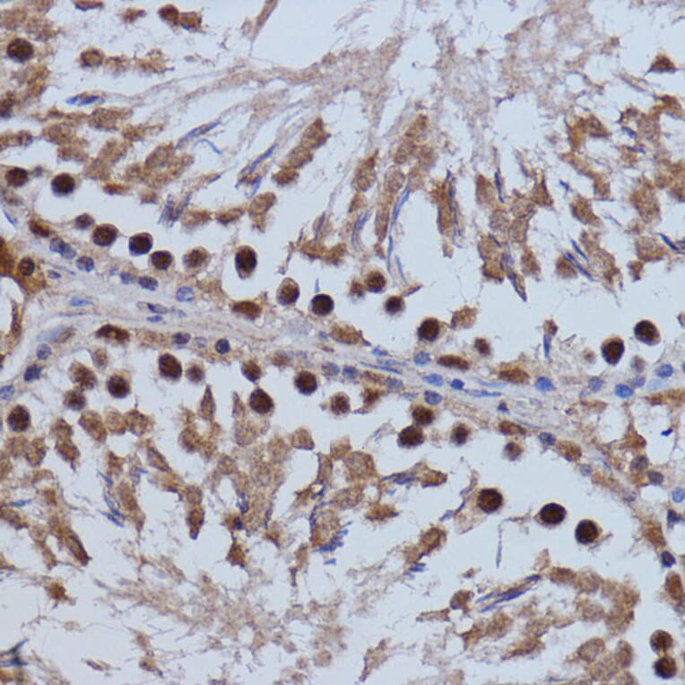 Immunohistochemistry - Anti-Brd4 Antibody (A13967) - Antibodies.com