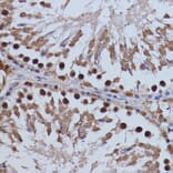 Immunohistochemistry - Anti-Brd4 Antibody (A13967) - Antibodies.com
