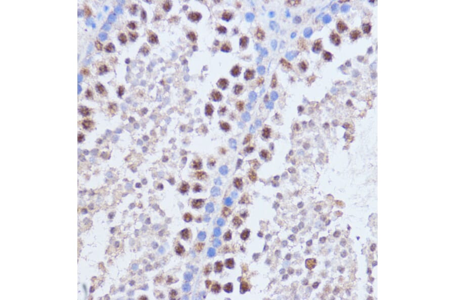 Immunohistochemistry - Anti-Brd4 Antibody (A13967) - Antibodies.com