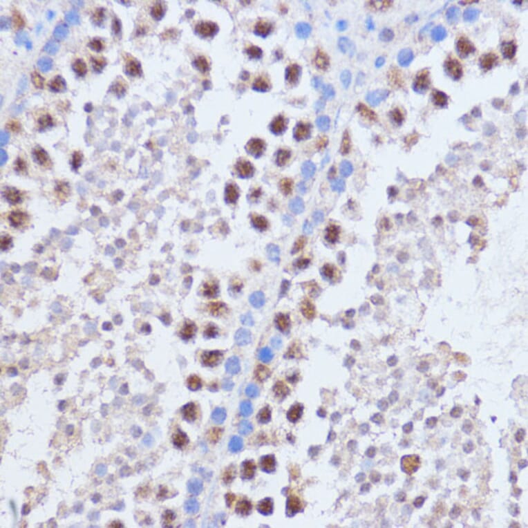 Immunohistochemistry - Anti-Brd4 Antibody (A13967) - Antibodies.com