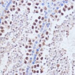 Immunohistochemistry - Anti-Brd4 Antibody (A13967) - Antibodies.com