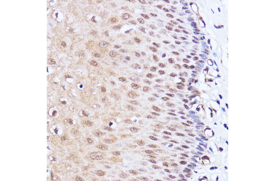Immunohistochemistry - Anti-Brd4 Antibody (A13967) - Antibodies.com