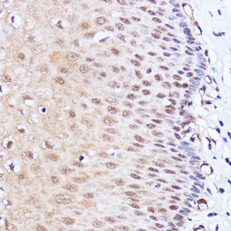 Immunohistochemistry - Anti-Brd4 Antibody (A13967) - Antibodies.com