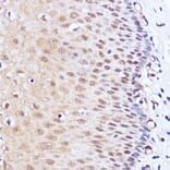 Immunohistochemistry - Anti-Brd4 Antibody (A13967) - Antibodies.com
