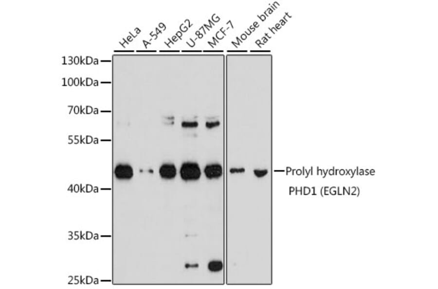 Western Blot - Anti-PHD1/prolyl hydroxylase Antibody (A13968) - Antibodies.com
