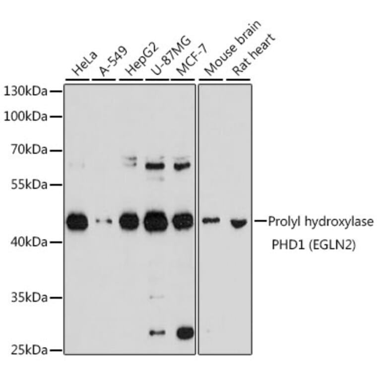 Western Blot - Anti-PHD1/prolyl hydroxylase Antibody (A13968) - Antibodies.com
