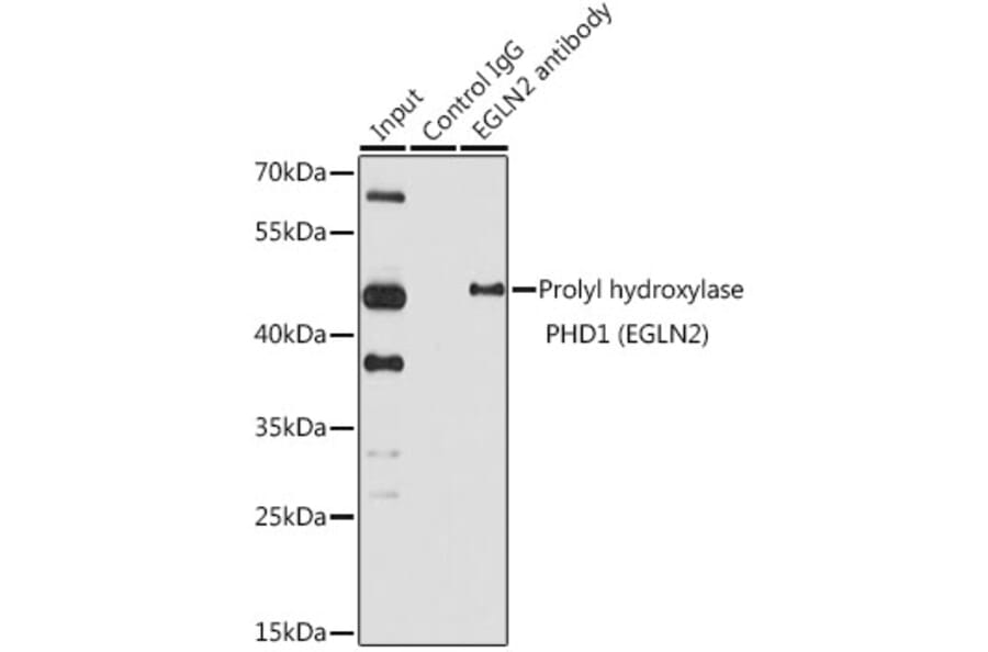 Western Blot - Anti-PHD1/prolyl hydroxylase Antibody (A13968) - Antibodies.com