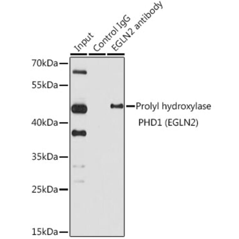 Western Blot - Anti-PHD1/prolyl hydroxylase Antibody (A13968) - Antibodies.com