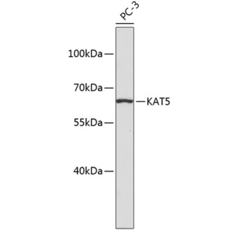 Western Blot - Anti-KAT5 Antibody (A2292) - Antibodies.com