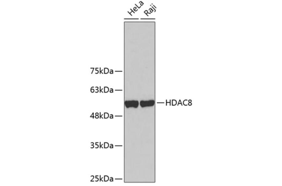 Western Blot - Anti-HDAC8 Antibody (A2323) - Antibodies.com