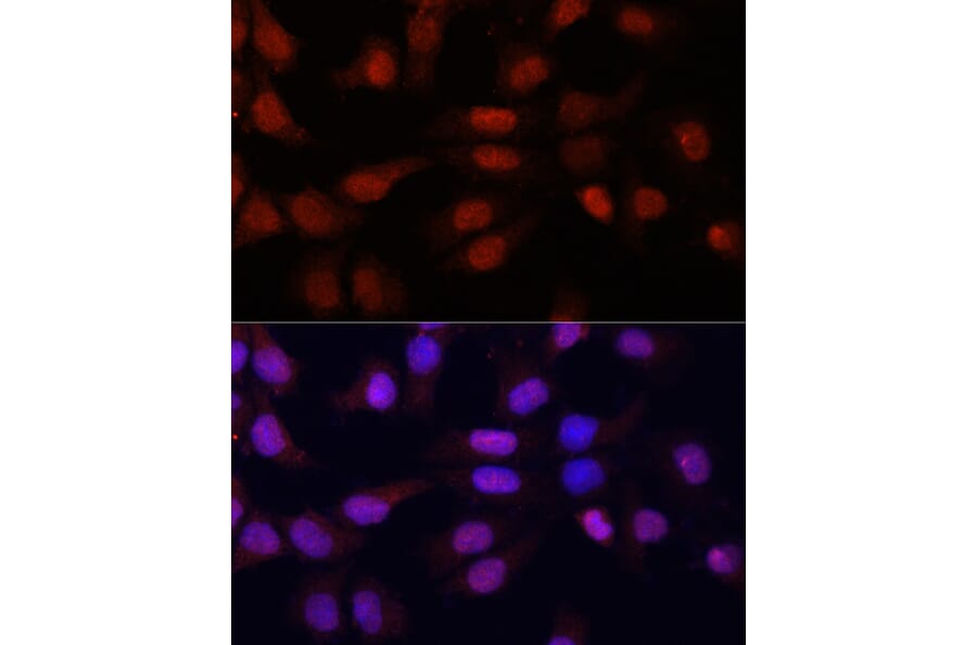 Immunofluorescence - Anti-N5-Methylcytidine Antibody (A13975) - Antibodies.com