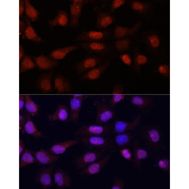 Immunofluorescence - Anti-N5-Methylcytidine Antibody (A13975) - Antibodies.com
