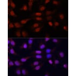 Immunofluorescence - Anti-N5-Methylcytidine Antibody (A13975) - Antibodies.com