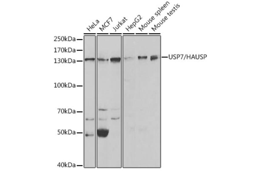 Western Blot - Anti-HAUSP / USP7 Antibody (A13977) - Antibodies.com