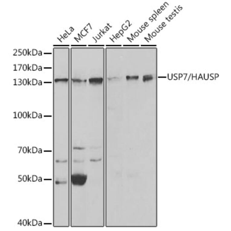 Western Blot - Anti-HAUSP / USP7 Antibody (A13977) - Antibodies.com