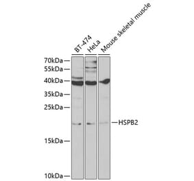 Western Blot - Anti-Hsp27 Antibody (A13979) - Antibodies.com