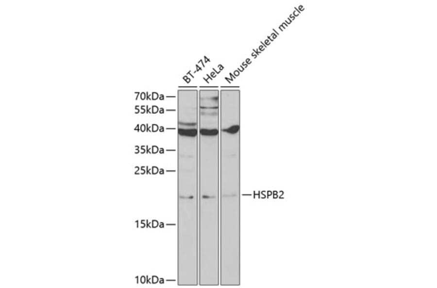 Western Blot - Anti-Hsp27 Antibody (A13979) - Antibodies.com