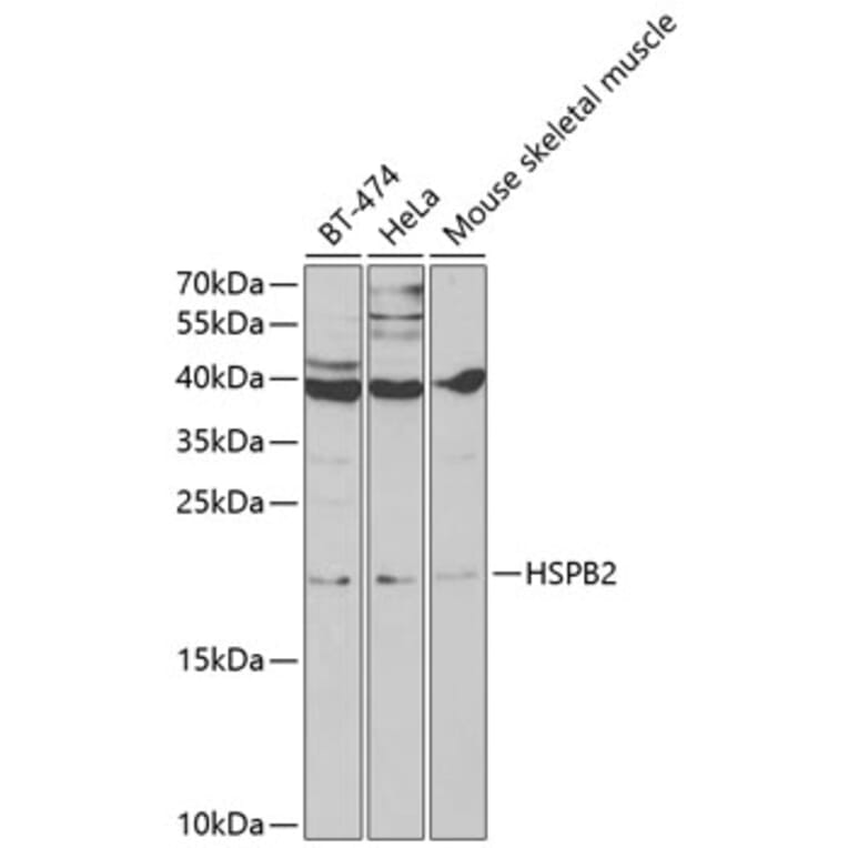 Western Blot - Anti-Hsp27 Antibody (A13979) - Antibodies.com