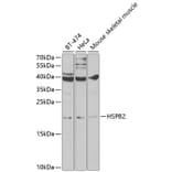 Western Blot - Anti-Hsp27 Antibody (A13979) - Antibodies.com