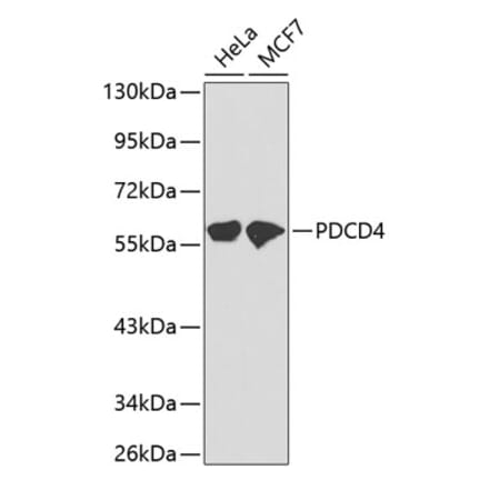 Western Blot - Anti-PDCD4 Antibody (A13980) - Antibodies.com