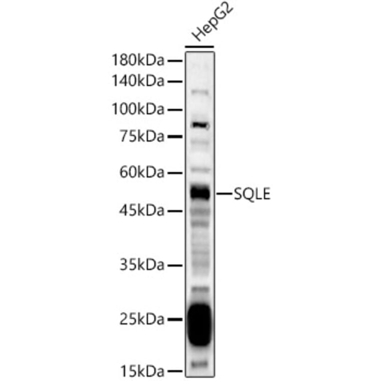 Western Blot - Anti-Squalene Epoxidase Antibody (A13981) - Antibodies.com