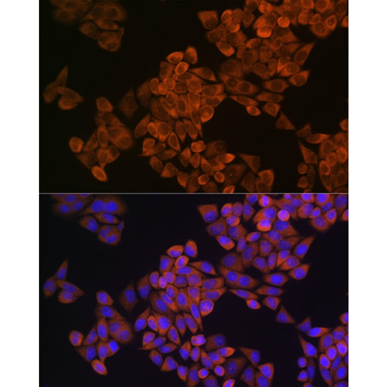 Immunofluorescence - Anti-Squalene Epoxidase Antibody (A13981) - Antibodies.com