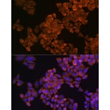 Immunofluorescence - Anti-Squalene Epoxidase Antibody (A13981) - Antibodies.com