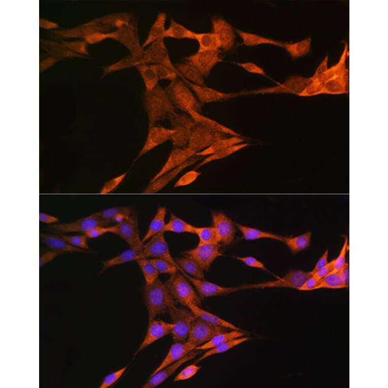 Immunofluorescence - Anti-Squalene Epoxidase Antibody (A13981) - Antibodies.com
