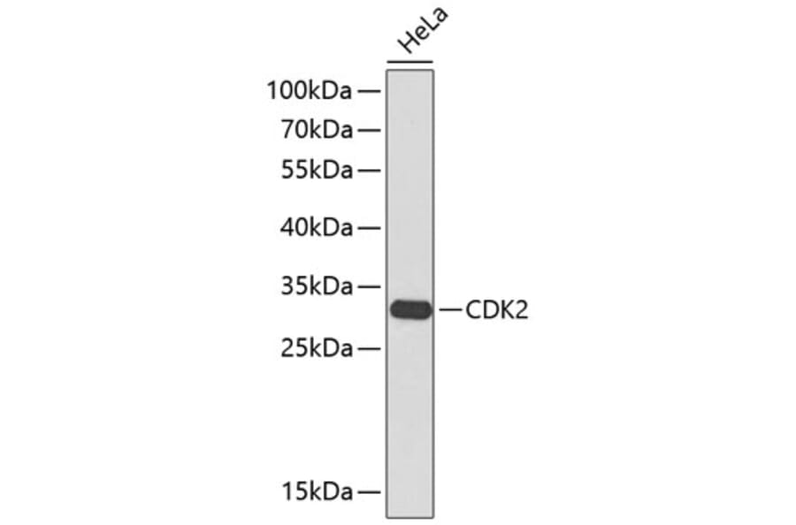 Western Blot - Anti-CDK2 Antibody (A2439) - Antibodies.com