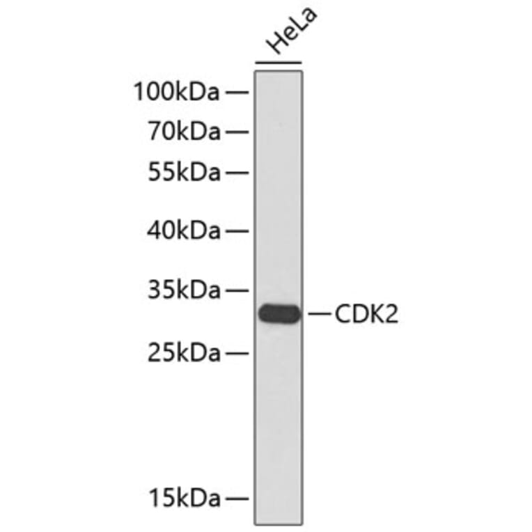 Western Blot - Anti-CDK2 Antibody (A2439) - Antibodies.com