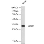 Western Blot - Anti-CDK2 Antibody (A2439) - Antibodies.com