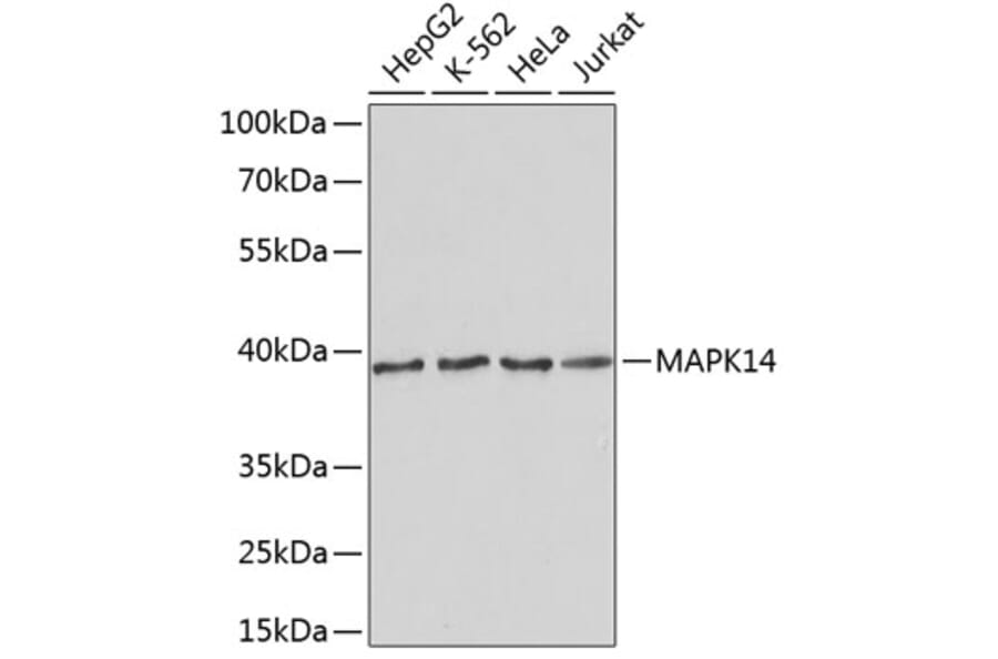 Western Blot - Anti-MAPK14 Antibody (A2441) - Antibodies.com