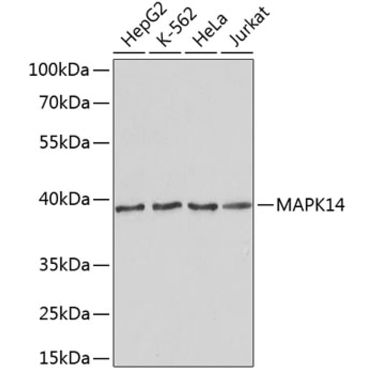 Western Blot - Anti-MAPK14 Antibody (A2441) - Antibodies.com