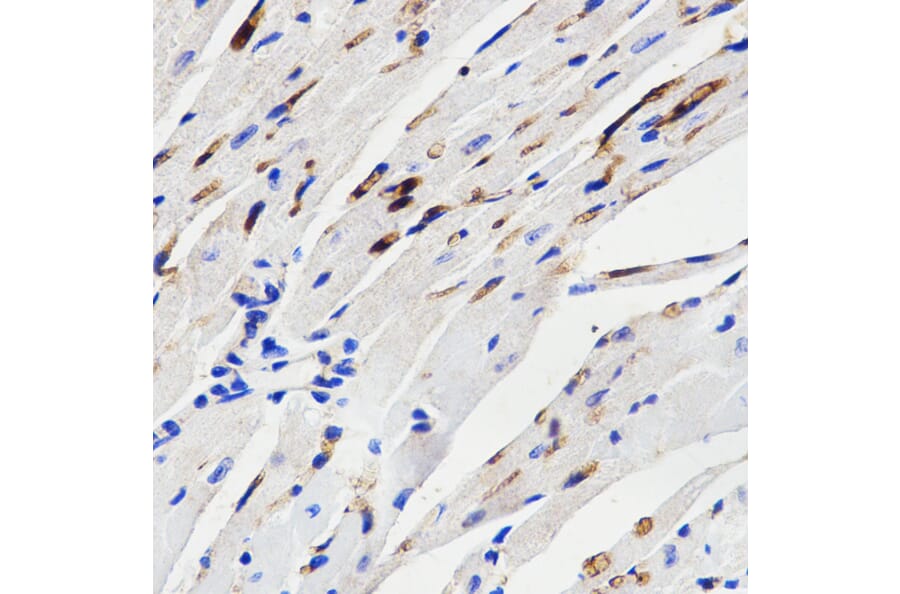 Immunohistochemistry - Anti-MAPK14 Antibody (A2441) - Antibodies.com