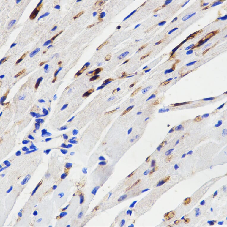Immunohistochemistry - Anti-MAPK14 Antibody (A2441) - Antibodies.com