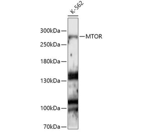 Western Blot - Anti-mTOR Antibody (A13984) - Antibodies.com