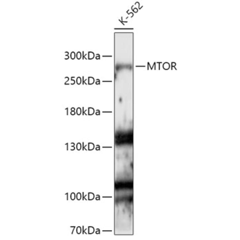 Western Blot - Anti-mTOR Antibody (A13984) - Antibodies.com