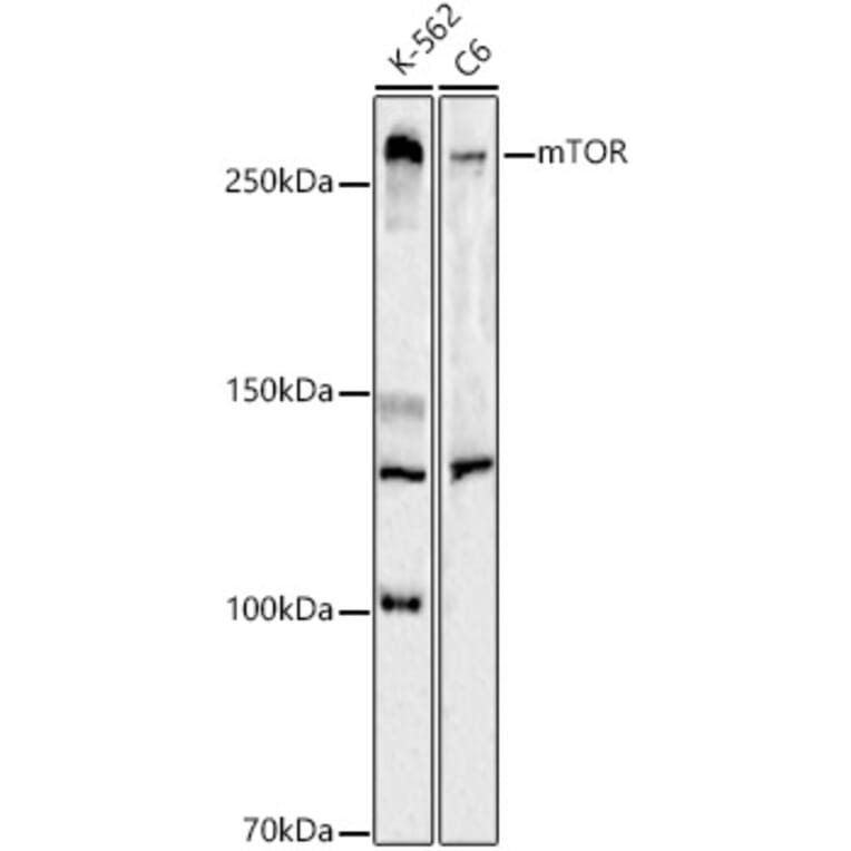 Western Blot - Anti-mTOR Antibody (A13984) - Antibodies.com