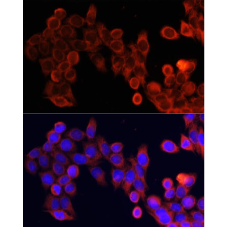 Immunofluorescence - Anti-mTOR Antibody (A13984) - Antibodies.com
