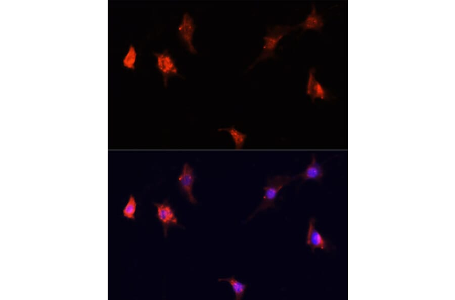Immunofluorescence - Anti-mTOR Antibody (A13984) - Antibodies.com