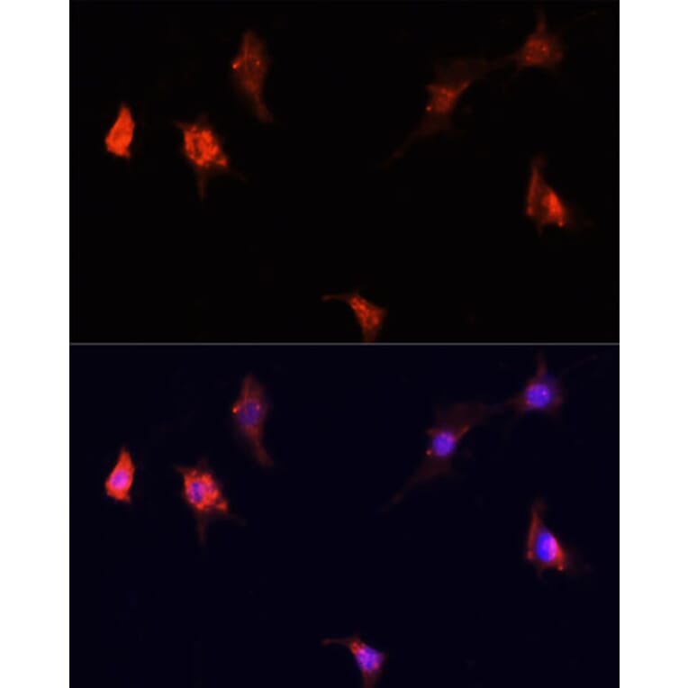 Immunofluorescence - Anti-mTOR Antibody (A13984) - Antibodies.com