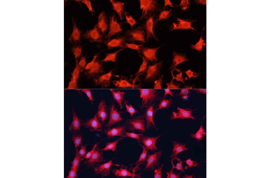 Immunofluorescence - Anti-mTOR Antibody (A13984) - Antibodies.com